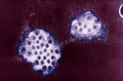 Mikroskop-Aufnahme des Norovirus