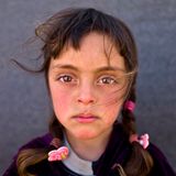 UNICEF Siegerbild: Zahras Gesicht