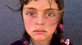 UNICEF Siegerbild: Zahras Gesicht