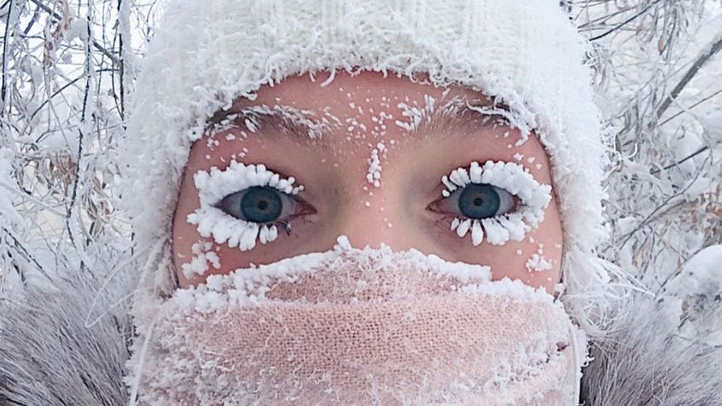 In Russlands Teilrepublik Jakutien herrscht Frost: Diese Frau hat nur 20 Minuten an der frischen Luft verbracht.