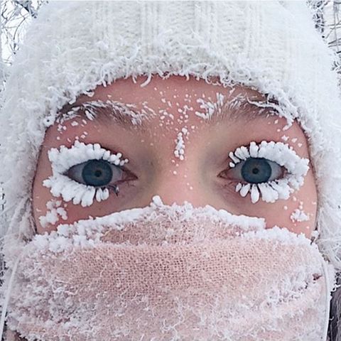 In Russlands Teilrepublik Jakutien herrscht Frost: Diese Frau hat nur 20 Minuten an der frischen Luft verbracht.