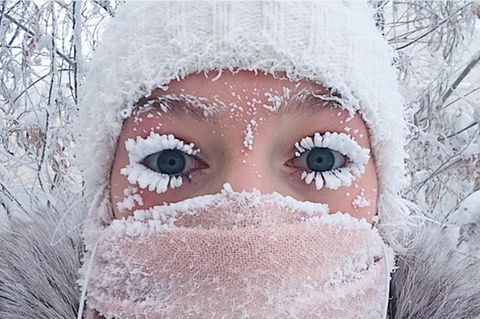 In Russlands Teilrepublik Jakutien herrscht Frost: Diese Frau hat nur 20 Minuten an der frischen Luft verbracht.