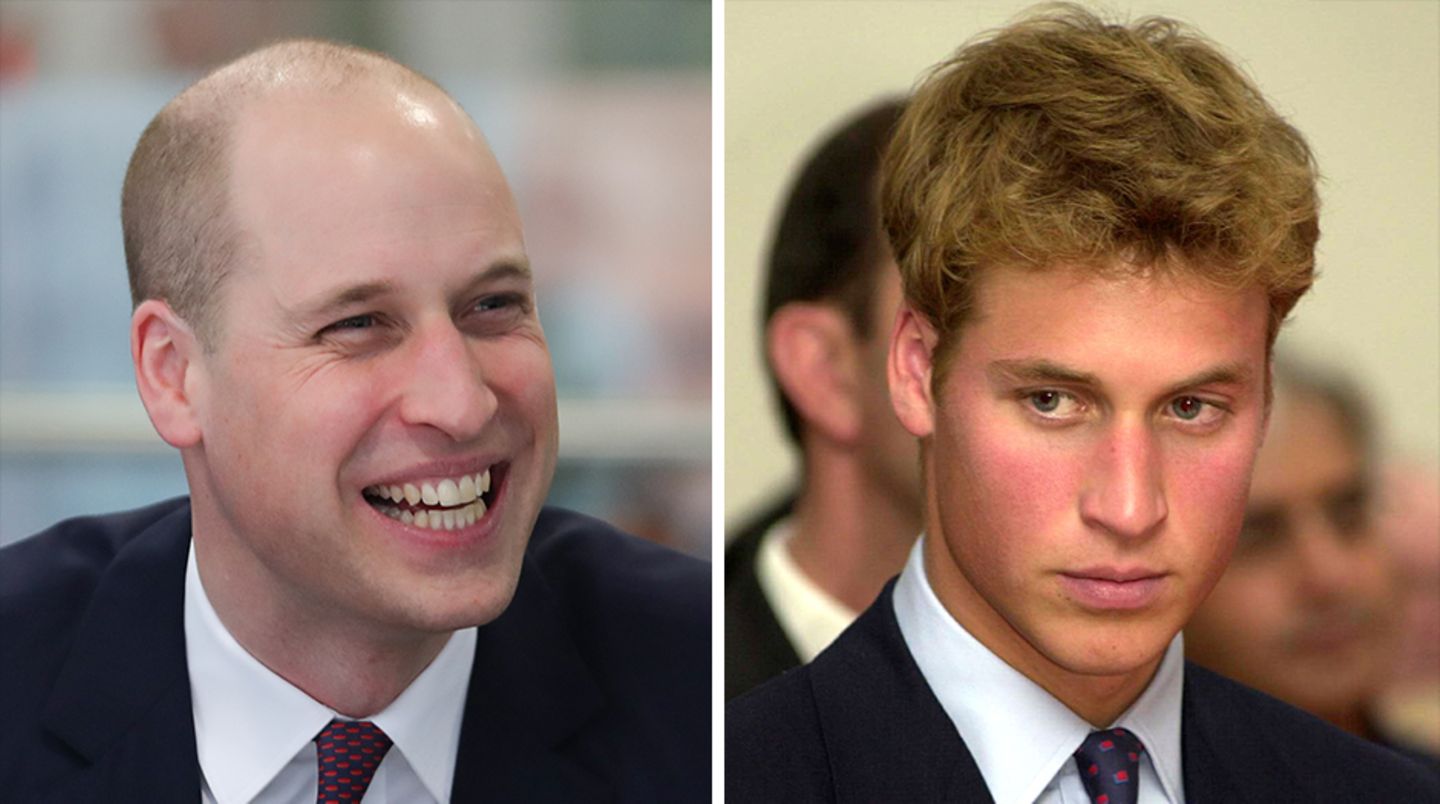 Prinz William hat kaum noch Haare