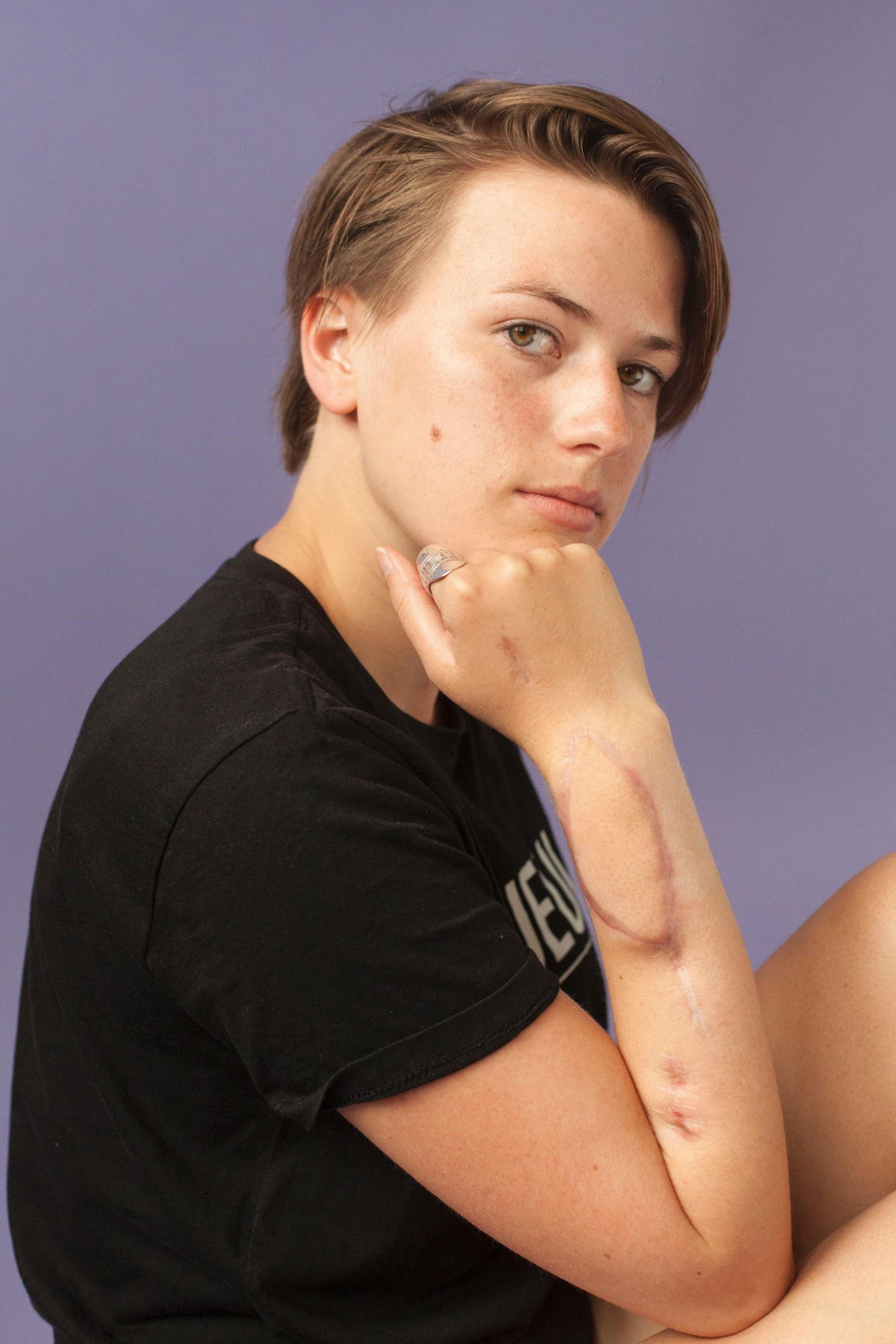 Adele - Das ist die Geschichte ihrer Narben