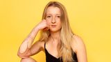 Anna - Das ist die Geschichte ihrer Narben