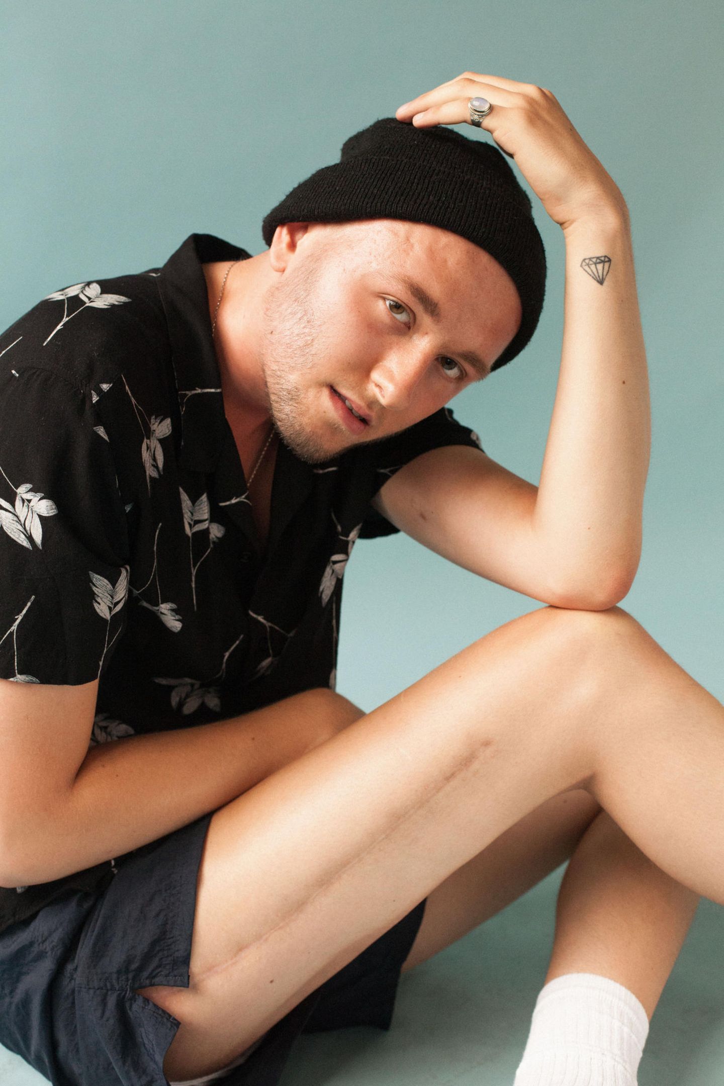 Billy - Das ist die Geschichte seiner Narben