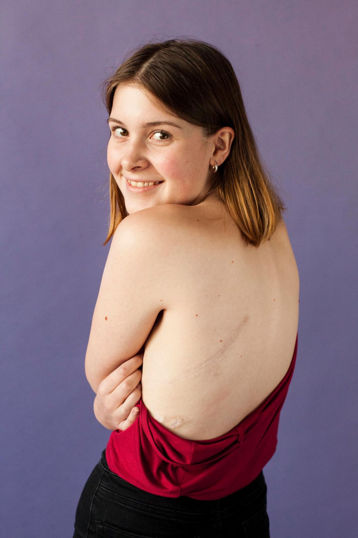 Nell - Das ist die Geschichte ihrer Narben