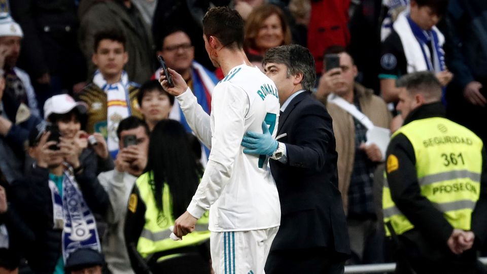 Cristiano Ronaldo checkt seine Kopfverletzung mit der Smartphone-Frontkamera