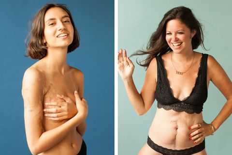Fotoreihe "Behind the Scars": Mutig und unverstellt: Diese Menschen zeigen, was viele lieber verstecken