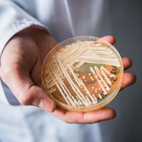Eine Petrischale mit Candida auris