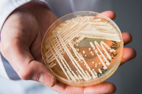 Eine Petrischale mit Candida auris