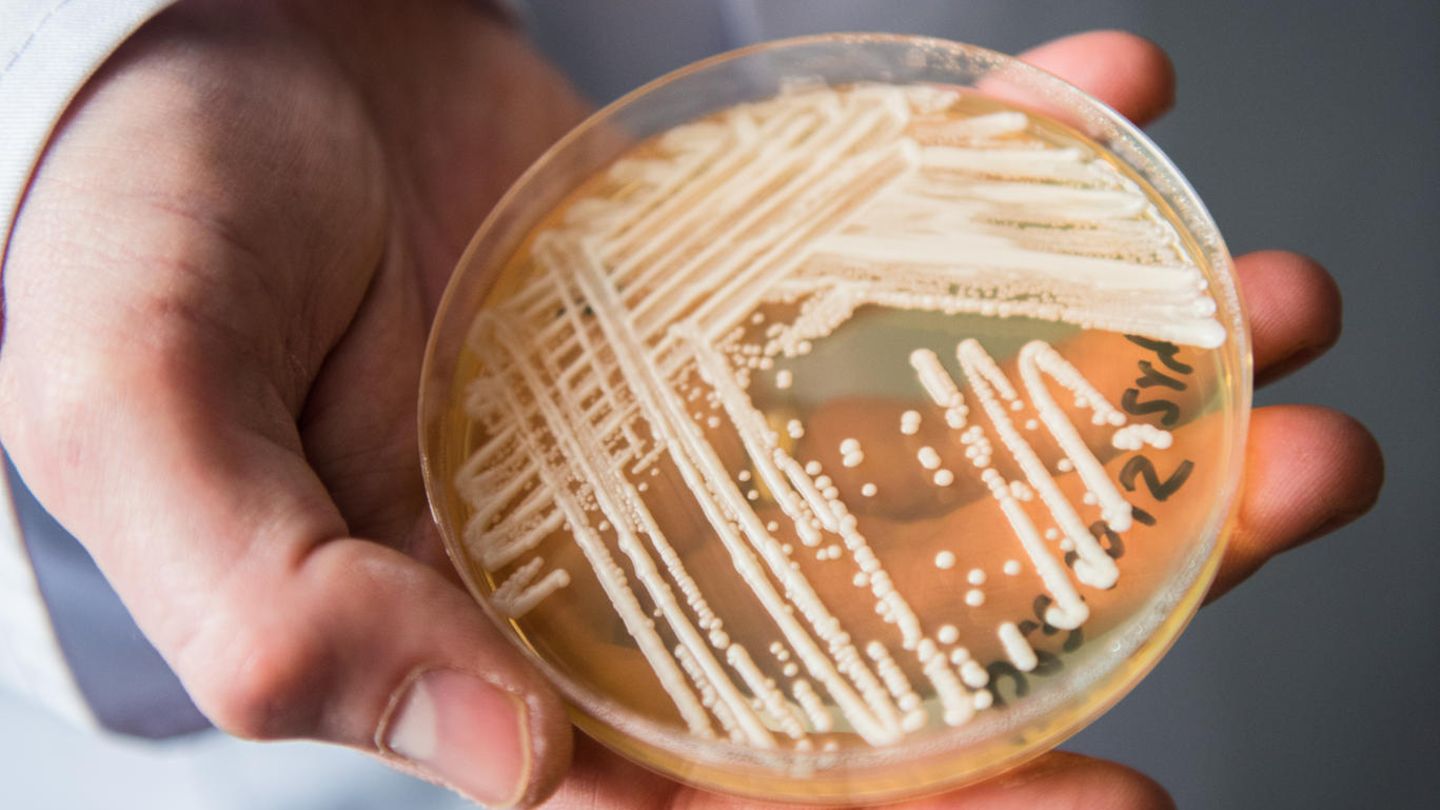 Eine Petrischale mit Candida auris