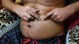 Eine Narbe am Bauch des Drogendealers Samo