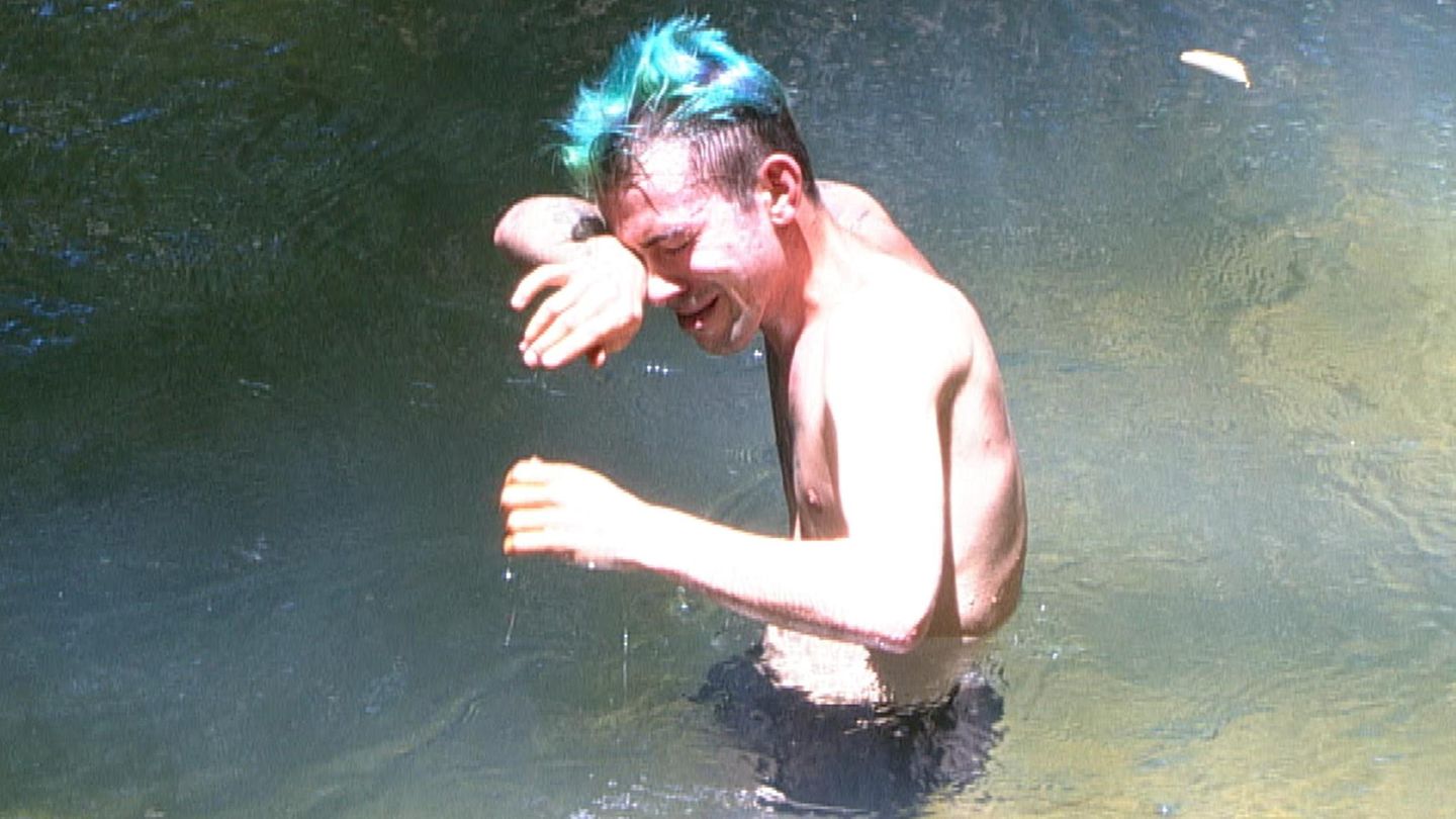 Daniele Negroni kühlt seine Verbrennung im Teich