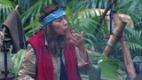 Tina York hat sich die Hand verbrannt
