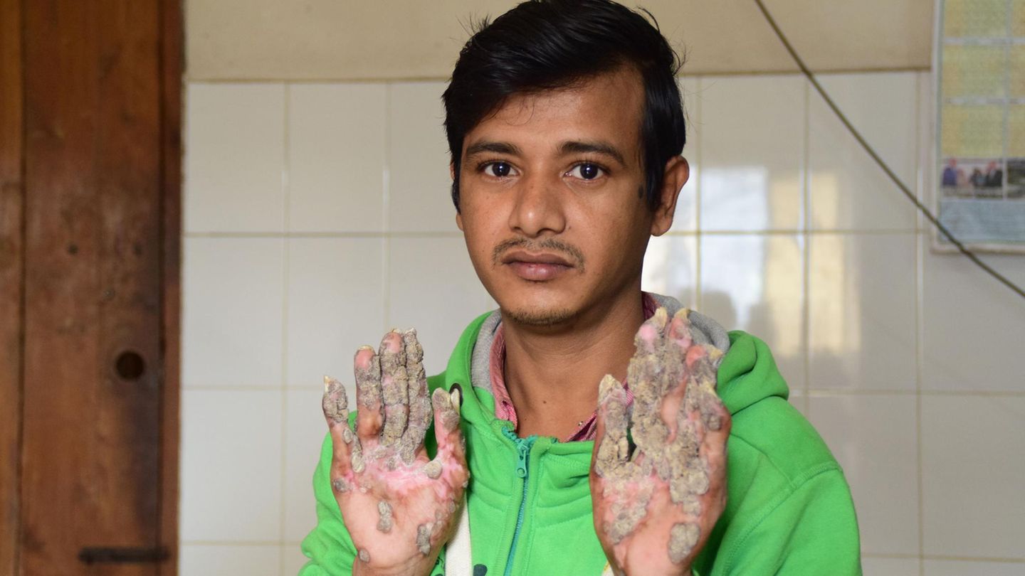 Abul Bajandar aus Bangladesch