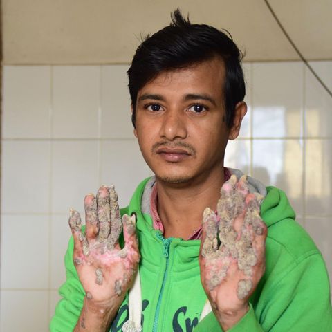 Abul Bajandar aus Bangladesch