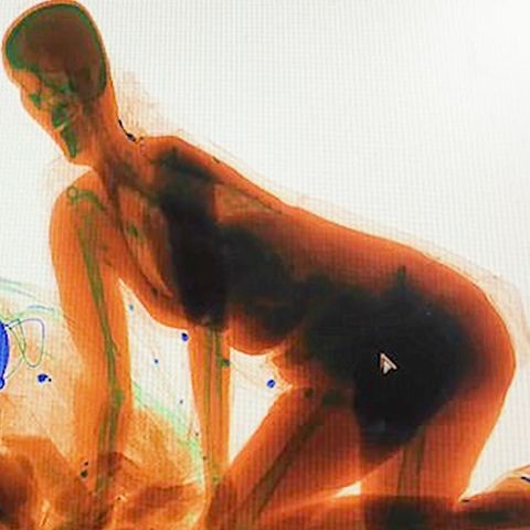 Paranoia bei der Sicherheitskontrolle: Frau klettert auf High Heels in Gepäck-Scanner
