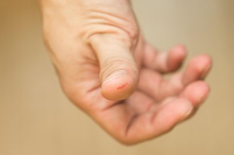 Eine kleine Schnittwunde am Finger