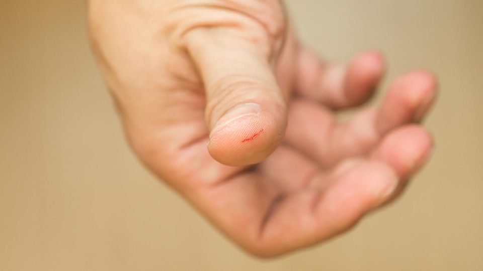 Eine kleine Schnittwunde am Finger Eine kleine Schnittwunde am Finger