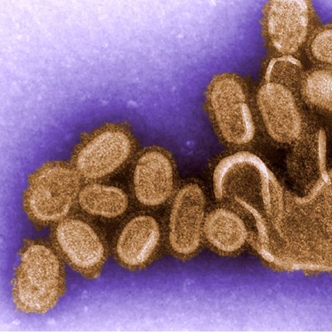Influenza-Viren unter einem Elektronenmikroskop