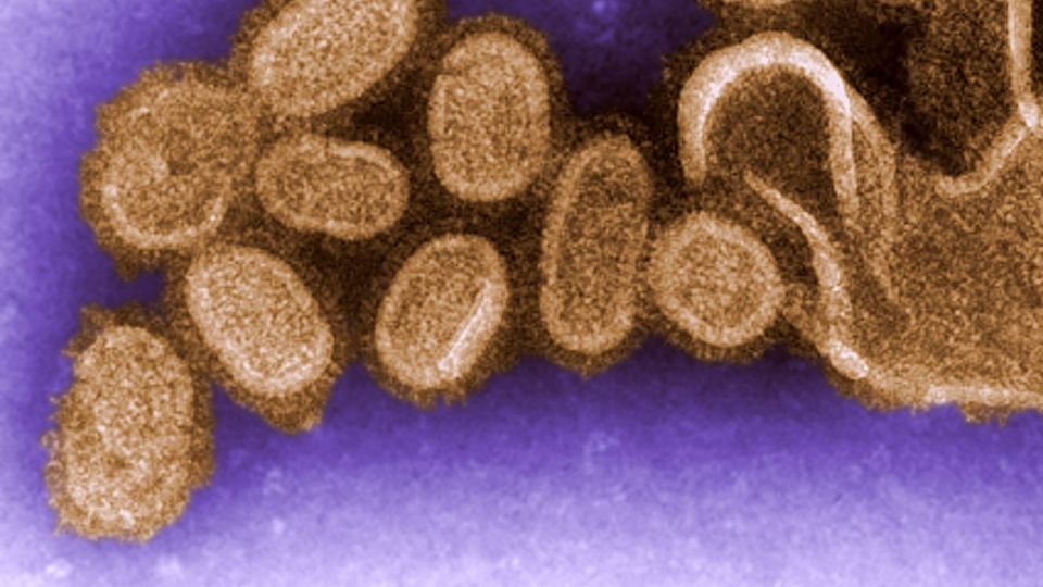 Influenza-Viren unter einem Elektronenmikroskop