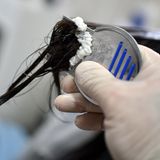 Mit einem speziellen Läusekamm werden Nissen aus den Haaren gekämmt. Die Methode mit Heißluft ist nicht unumstritten - so warnt das Robert Koch-Institut vor möglichen Schäden für die Kopfhaut.