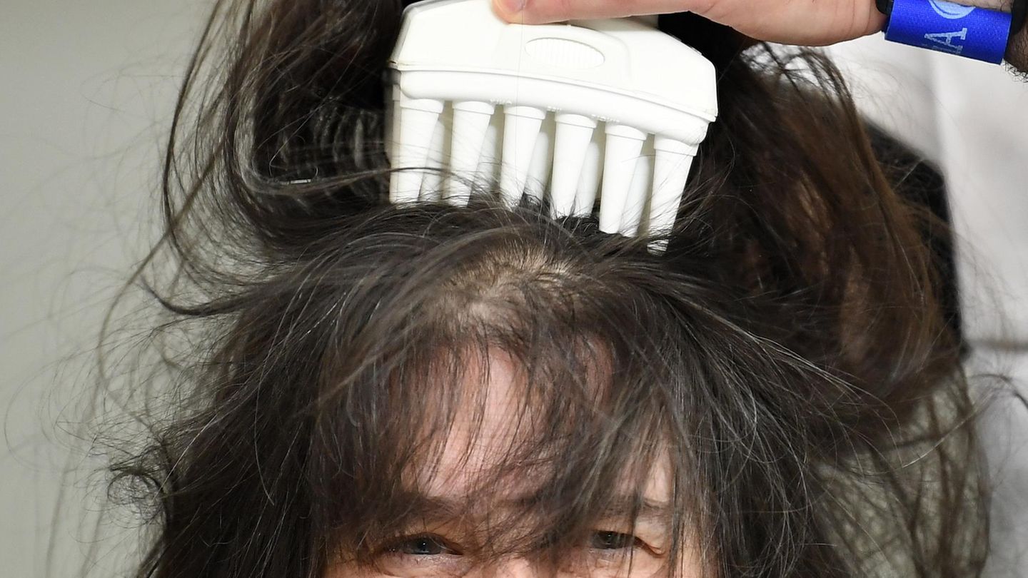 Für die Eigenbehandlung gegen Läuse empfehlen Experten einen speziellen Läusekamm, mit dem Strähne für Strähne inspiziert werden sollte. Im Anschluss sollte ein Insektizid - also ein Mittel zum Abtöten von Insekten - aufgetragen werden. Nach einigen Tagen sollte die Behandlung wiederholt werden.