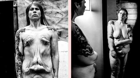 "Self Untitled": Die nackte Wahrheit: Künstlerin zeigt, wie ihr Körper mit einem Magenbypass aussieht