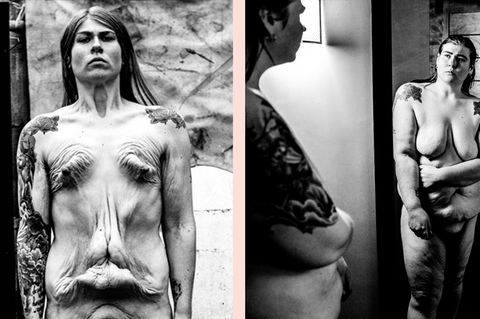"Self Untitled": Die nackte Wahrheit: Künstlerin zeigt, wie ihr Körper mit einem Magenbypass aussieht