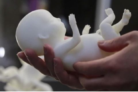Werdende Mütter bekommen Fötus-Modell aus dem 3D-Drucker