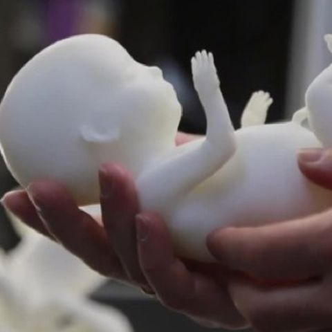 Werdende Mütter bekommen Fötus-Modell aus dem 3D-Drucker