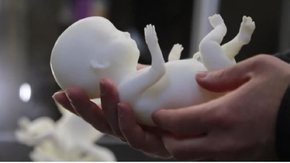 Werdende Mütter bekommen Fötus-Modell aus dem 3D-Drucker Werdende Mütter bekommen Fötus-Modell aus dem 3D-Drucker