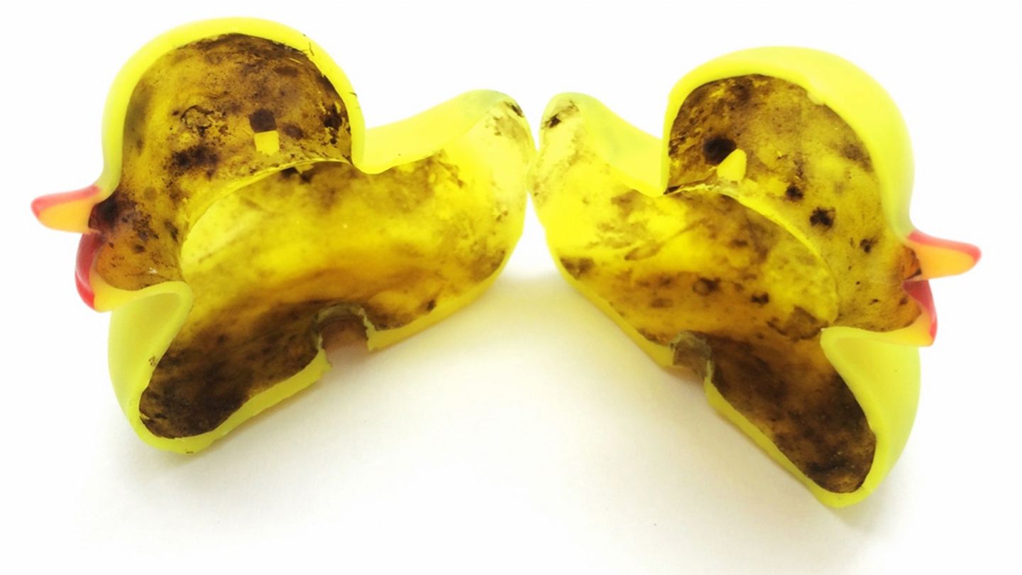 Keime, Bakterien, Pilze - das unappetitliche Innenleben einer Gummiente
