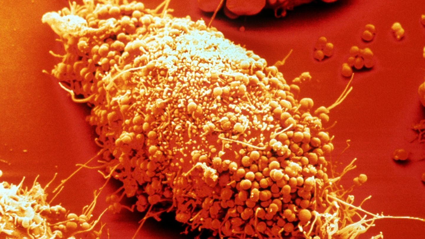 Hier haben sich zahlreiche Neisserien, die Erreger der Gonorrhoe (Tripper), an die Oberfläche einer Epithelzelle angeheftet; sie sind im Begriff, in die Zelle einzudringen. Epithelzellen sind die oberste Schicht des menschlichen Haut-und Schleimhautgewebes.
