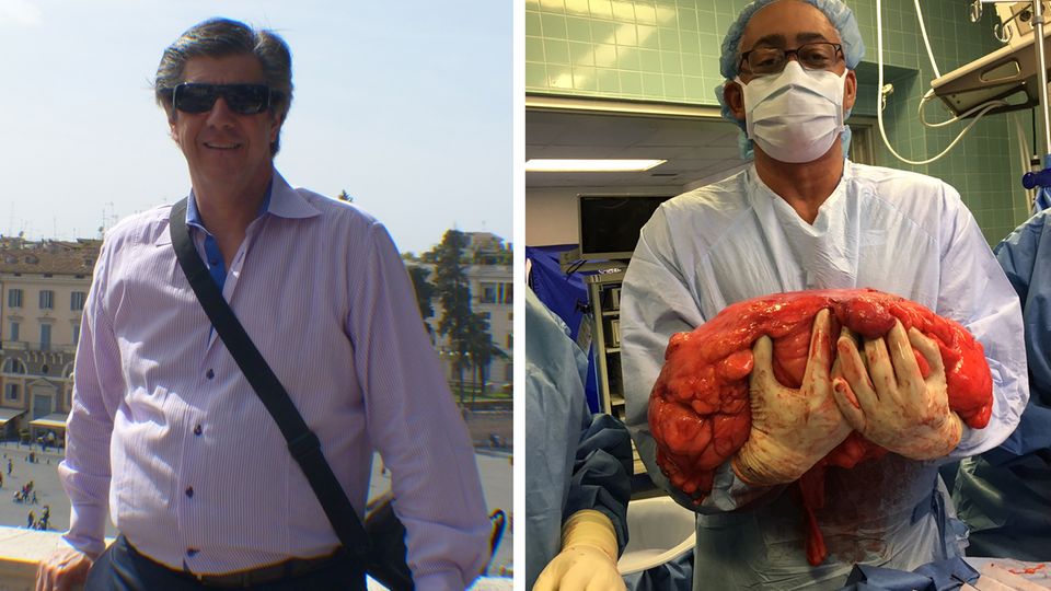 Kevin Daly mit "Bierbauch" - Ärzte entfernen Tumor Kevin Daly mit "Bierbauch" - Ärzte entfernen Tumor