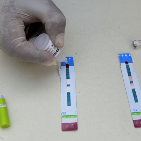 Ein Aids-Test (Symbolbild)