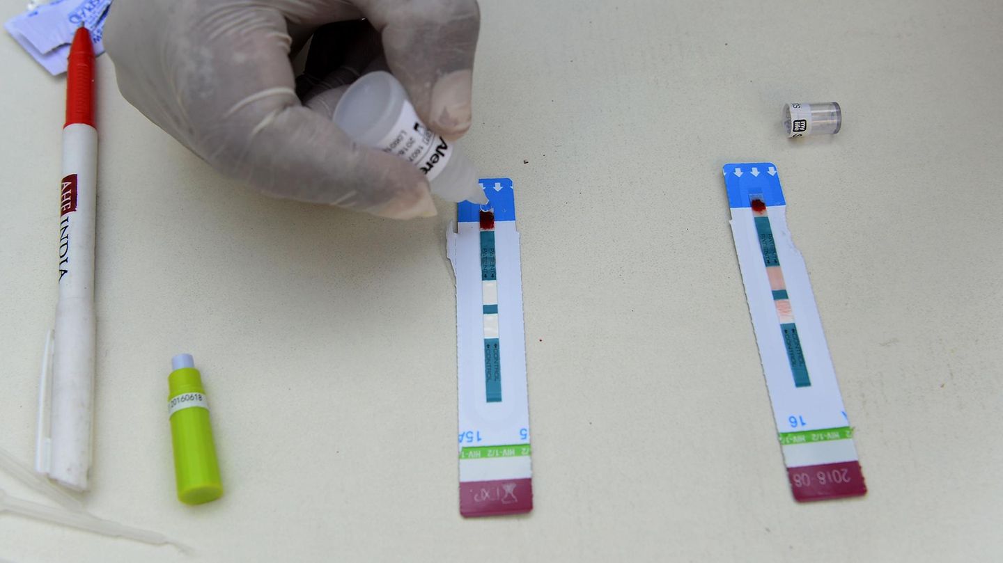Ein Aids-Test (Symbolbild)