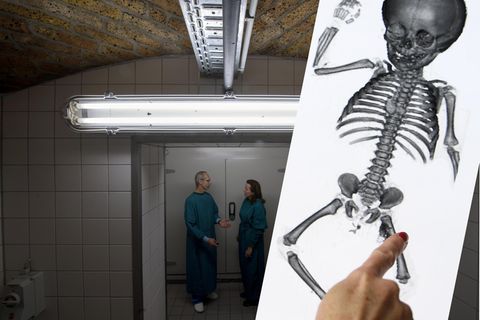 Keller des Instituts für Anatomie der Uni Halle (Saale), CT-Aufnahme einer Kinderleiche