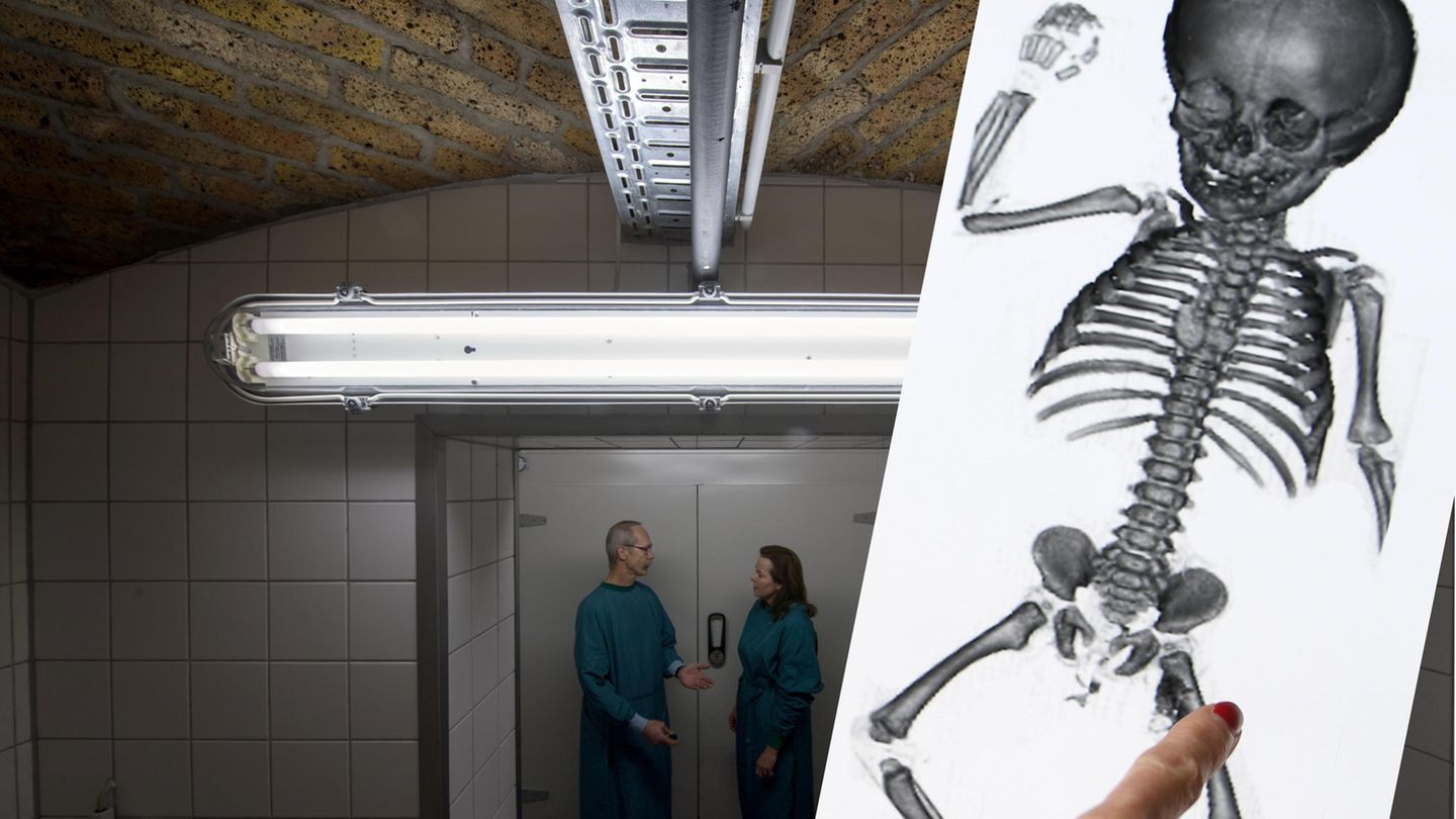 Keller des Instituts für Anatomie der Uni Halle (Saale), CT-Aufnahme einer Kinderleiche