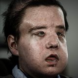 Jérôme Hamon nach seiner ersten Operation