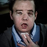 Portrait von Jérôme Hamon nach Operation