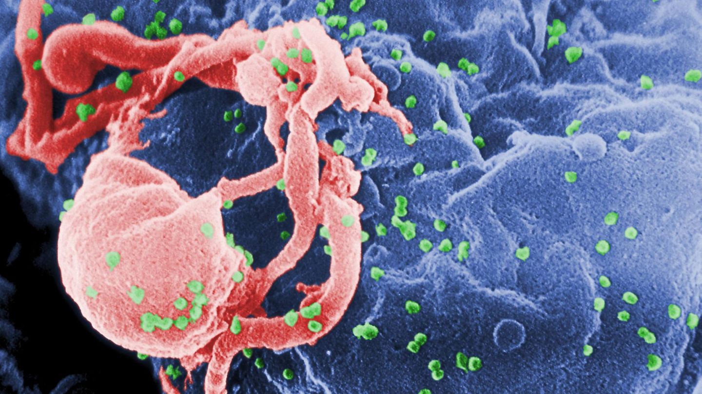 HIV Virus