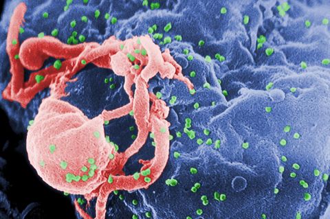 HIV Virus