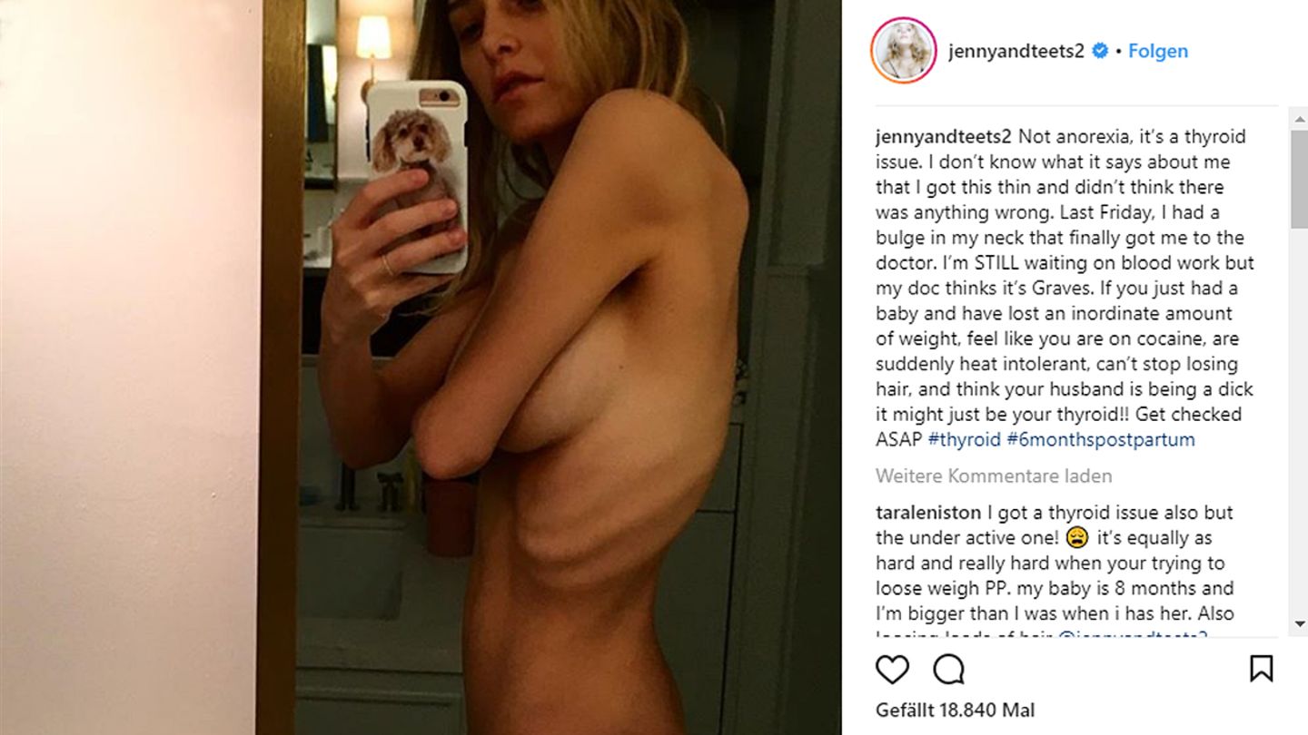 Jenny Mollen veröffentlichte dieses Selfie auf ihrem Instagram-Account