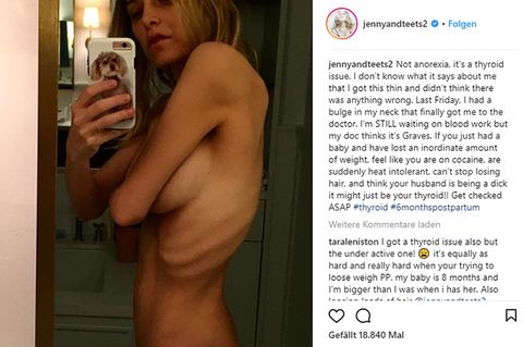 Jenny Mollen veröffentlichte dieses Selfie auf ihrem Instagram-Account