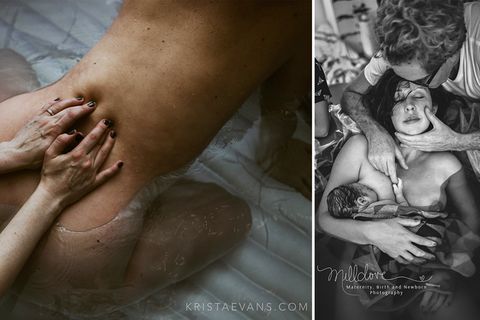 "IAPBP"-Fotowettbewerb: Diese Bilder zeigen die Schönheit der Geburt