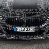 Die charakteristische Niere ist deutlich zu erkennen