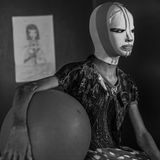 Fotograf: Alessio Mamo     10. Juli 2017    2. Preis im Segment "Einzelfotos"  Manal (11), Opfer einer Raketenexplosion in Kirkuk, Irak, trägt mehrere Stunden täglich eine Maske zum Schutz ihres Gesichts, nach umfassenden plastischen Operationen im Rahmen des Programms für rekonstruktive Chirurgie von Ärzte ohne Grenzen im Al-Mowasah-Krankenhaus in Amman, Jordanien.    In diesem Krankenhaus leben - mit Verwandten oder Freunden - Kinder und Erwachsene aus dem Jemen, aus Irak, Syrien und Gaza, die schwere Verletzungen durch Bomben, Autoexplosionen oder andere Unfälle erlitten haben. Manal, die mit ihrer Mutter und zwei Brüdern vertrieben wurde, erlitt schwere Verbrennungen an Gesicht und Armen. Bevor sie nach Jordanien kam, war sie noch nicht operiert worden und konnte sie ihr rechtes Auge nicht richtig schließen. Nach vielen plastischen Operationen trägt sie jetzt mehrere Stunden täglich ihre Maske, die ihre Haut vor dem Licht schützen soll. Manal hat viele Freunde im Krankenhaus. Besonders gern mag sie Zeichnen und Geschichtenerzählen und die vielen für die Kinder organisierten Aktivitäten.