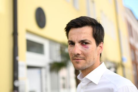 Nach Angriff auf Wahlparty: "Ich habe mir am meisten Sorgen um meine Frau gemacht", sagt Martin Horn